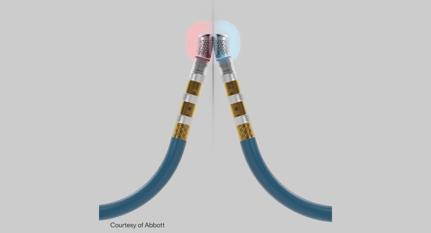 Abbott Earns CE Mark for TactiFlex Duo Dual-Energy Ablation Catheter